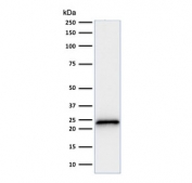 Western blot testing of human HeLa cell lysate with anti-p21 antibody (clone SPM306).