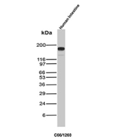 CEA Antibody Intestine WB. Western blot analysis of CEA / CEACAM5 expression in human intestine tissue lysate using CEA antibody, clone C66/1260. Lane 1: human intestine tissue lysate. A prominent band is detected at approximately 180-200 kDa, consistent with the predicted molecular weight of CEACAM5, with higher apparent migration reflecting extensive glycosylation characteristic of this cell surface adhesion glycoprotein.