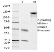 SDS-PAGE analysis of purified, BSA-free Chromogranin A antibody (clone CHGA/798) as confirmation of integrity and purity.
