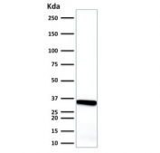 Calponin Antibody Endometrium Tissue WB. Western blot testing of human endometrium tissue lysate with Calponin antibody. Predicted molecular weight ~34 kDa.