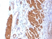 Calponin 1 Antibody Rat Uterus IHC. Immunohistochemistry analysis of FFPE rat uterus tissue using Calponin 1 antibody. The mouse monoclonal antibody clone CNN1/832 shows strong HRP-DAB brown cytoplasmic staining in smooth muscle cells of the myometrial layer, with signal outlining contractile structures consistent with Calponin 1 / CNN1 expression. Surrounding stromal and non-smooth muscle components exhibit minimal background staining, supporting specificity for smooth muscle lineage cells.