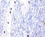 G-CSF Antibody Tonsil Immunohistochemistry. IHC: Formalin-fixed, paraffin-embedded human tonsil stained with G-CSF antibody (CSF3/900). Note specific cytoplasmic staining of granulocytes.
