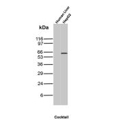 AFP Antibody Human Liver and HepG2 WB. Western blot analysis of human liver and HepG2 cell lysates using AFP Antibody (clone MBS-12) detects a band at approximately 65-70 kDa in HepG2 cells, consistent with the expected molecular weight of Alpha fetoprotein. No band is observed in adult human liver lysate, reflecting the known suppression of AFP expression in normal adult liver and its re-expression in hepatocellular carcinoma-derived cells.