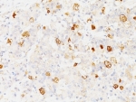 FSHB Antibody Endocrine Cell Marker IHC. Immunohistochemical analysis of FFPE human pituitary using monoclonal clone SPM107 reveals punctate cytoplasmic HRP-DAB brown staining localized to dispersed endocrine cells within the adenohypophysis. The staining pattern is characteristic of secretory gonadotroph cells expressing Follicle stimulating hormone beta / FSHB.
