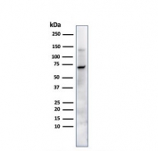 Placental Alkaline Phosphatase Antibody for WB. Western blot testing of human JEG-3 cell lysate with Placental Alkaline Phosphatase antibody. A band is detected at approximately 60-70 kDa, which is slightly higher than the predicted molecular weight of 58 kDa for Placental alkaline phosphatase / ALPP. The upward shift is consistent with glycosylation of this GPI-anchored membrane enzyme, which commonly alters apparent migration on SDS-PAGE.