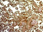 PLAP Antibody Clone SPM593 Placenta IHCImmunohistochemistry of PLAP Antibody Clone SPM593 in human placenta. Formalin-fixed, paraffin-embedded human placental tissue demonstrates strong HRP-DAB brown membranous staining in syncytiotrophoblastic cells lining chorionic villi, consistent with surface localization of placental alkaline phosphatase. Stromal and intervillous cells show minimal staining.
