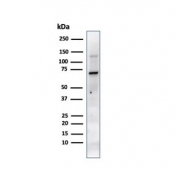 Western blot testing of human JEG-3 cell lysate with Placental Alkaline Phosphatase antibody (PL8-F6). Predicted molecular weight ~58 kDa but routinely visualized at 60-70 kDa.