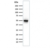 Western blot testing of human brain lysate with GFAP antibody (clone ASTRO/789). Predicted molecular weight ~50 kDa.