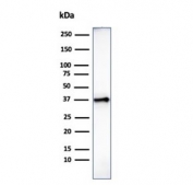 Histone H1 Antibody for WB. Western blot analysis of total histone H1 expression in human heart tissue lysate. A band is detected at approximately 22-33 kDa, consistent with the predicted molecular weight range of Histone H1 family proteins, with lower bands corresponding to unmodified forms and higher bands reflecting post-translationally modified variants. The observed band pattern aligns with the known heterogeneity of linker histone H1 isoforms and their modification-dependent mobility in chromatin-associated proteins.