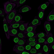 Histone H1 Antibody for IF. Immunofluorescence analysis of chromatin condensation-associated histone H1 expression in permeabilized human HeLa cells using Histone H1 Antibody (green). Strong nuclear staining is observed, consistent with localization of linker histone H1 within condensed chromatin regions and its role in higher-order chromatin organization. Clone SPM256 antibody demonstrates nuclear enrichment with minimal cytoplasmic signal. Actin filaments are labeled with phalloidin (red), providing cytoskeletal contrast to the chromatin-associated histone signal.