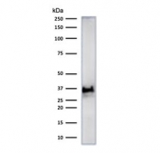 Histone H1 Antibody for WB. Western blot analysis of chromatin condensation-associated histone H1 expression in human heart tissue lysate. A band is detected at approximately 30-35 kDa, consistent with the predicted molecular weight range of Histone H1 family proteins and reflecting post-translationally modified forms associated with chromatin compaction. The observed band pattern aligns with the role of histone H1 in higher-order chromatin organization and condensed chromatin states.
