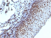 Histone H1 Antibody for IHC. Immunohistochemistry analysis of nucleosome spacing-associated histone H1 expression in FFPE human tonsil tissue using Histone H1 Antibody. Nuclear HRP-DAB brown staining is observed in lymphoid cells, consistent with localization of linker histone H1 within chromatin and its role in nucleosome spacing and linker DNA organization. Clone 1415-1 antibody demonstrates strong nuclear compartmentalization with minimal cytoplasmic staining, reflecting chromatin-associated distribution of histone H1.