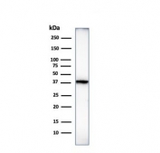 Histone H1 Antibody for WB. Western blot analysis of nucleosome spacing-associated histone H1 expression in human heart tissue lysate. A band is detected at approximately 22-33 kDa, consistent with the predicted molecular weight range of Histone H1 family proteins, with lower bands corresponding to unmodified forms and higher bands reflecting post-translationally modified variants. The observed band pattern aligns with the role of histone H1 in linker DNA organization and regulation of nucleosome spacing within chromatin.