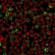 HLA-DR Antibody Clone LN3 immunofluorescence staining of human Ramos cells. Immunofluorescence analysis was performed using HLA-DR Antibody Clone LN3 to detect Human leukocyte antigen DR alpha / HLA-DRA (green), a major histocompatibility complex class II antigen expressed on B lymphocytes. Nuclei were counterstained with Reddot nuclear stain (red). The staining pattern shows strong membrane-associated signal consistent with HLA-DR expression on Ramos B lymphoma cells, a model cell line commonly used to study antigen-presenting immune cells.