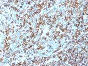 HLA-DR Antibody Clone LN3 immunohistochemistry staining of human tonsil tissue. IHC analysis of FFPE human tonsil was performed using HLA-DR Antibody Clone LN3 following heat induced epitope retrieval by boiling tissue sections in pH 9 10mM Tris with 1mM EDTA for 20 min and allowing sections to cool before testing. HRP-DAB brown staining highlights HLA-DR positive immune cells within the tonsillar lymphoid tissue, consistent with expression of Human leukocyte antigen DR alpha / HLA-DRA on antigen-presenting cells including B lymphocytes and other immune cells within germinal center regions.