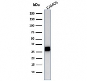 Western blot testing of human Ramos cell lysate with HLA-DR antibody (clone LN3). Expected molecular weight ~30 kDa.