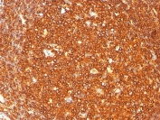 IHC staining of FFPE human tonsil with HLA-DRB1 antibody SPM289. HIER: boil tissue sections in pH 9 10mM Tris with 1mM EDTA for 10-20 min and allow to cool before testing.
