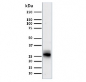 Western blot testing of human spleen lysate with HLA-DRB1 antibody (clone SPM423). Predicted molecular weight ~30 kDa.