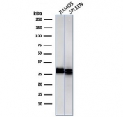 HLA-DRB1 Antibody for WB HLA-DRB/1067 western blot analysis of human samples. Western blot testing was performed using HLA-DRB1 Antibody for WB clone HLA-DRB/1067. Lane 1: human Ramos cell lysate, Lane 2: human spleen lysate. Bands are detected at approximately 28-32 kDa, consistent with the predicted molecular weight of HLA-DR beta chain / HLA-DRB1. The observed doublet likely reflects heterogeneous glycosylation or differentially processed forms of the HLA-DR beta chain commonly observed for MHC class II proteins in antigen-presenting immune cells.