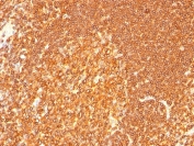 IHC: Formalin-fixed, paraffin-embedded human tonsil stained with HLA-DR antibody (LN3 + HLA-DRB/1067).