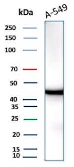 IDH1 Antibody IDH1/1152 Detects Endogenous IDH1 in A-549 Lung Cancer Cells WB. Western blot analysis of human A-549 lung carcinoma cell lysate using IDH1 Antibody, clone IDH1/1152. A strong, discrete band is detected at approximately 45-47 kDa, consistent with the expected molecular weight of cytosolic isocitrate dehydrogenase 1. The low background and absence of prominent additional bands demonstrate clean recognition of endogenous IDH1 in this human lung cancer cell line.