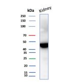 IDH1 Antibody IDH1/1152 Detects Endogenous IDH1 in Human Kidney WB. Western blot analysis of human kidney tissue lysate using IDH1 Antibody, clone IDH1/1152. A strong, discrete band is detected at approximately 45-47 kDa, consistent with the expected molecular weight of cytosolic isocitrate dehydrogenase 1. The prominent target band and limited additional reactivity demonstrate clean detection of endogenous IDH1 in human kidney tissue.