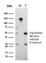 Purified Insulin-Like Growth Factor 1 Antibody IGF1/1020 Under Reducing and Non-Reducing Conditions. SDS-PAGE analysis of 2 ug of purified Insulin-Like Growth Factor 1 Antibody, clone IGF1/1020, under non-reducing (NR) and reducing (R) conditions. The non-reduced antibody migrates predominantly near 150 kDa. Following reduction, prominent bands corresponding to the antibody heavy and light chains are visible at approximately 50 kDa and 25 kDa, respectively. The observed banding pattern supports the integrity and purity of the monoclonal IGF-1 Protein Antibody preparation.