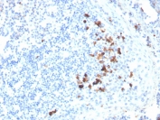 IgA Antibody Clone HISA43 in human tonsil by immunohistochemistry. Formalin-fixed paraffin-embedded human tonsil tissue stained with IgA Antibody Clone HISA43 shows HRP-DAB brown cytoplasmic staining in scattered plasma cells within the tonsillar lymphoid tissue, consistent with expression of Immunoglobulin alpha heavy chain (IGHA), the heavy chain component of IgA antibodies produced by differentiated B cells. Positive cells are primarily located in interfollicular regions and surrounding lymphoid follicles, while most surrounding lymphocytes remain negative. Heat induced epitope retrieval was performed by boiling tissue sections in pH 9 Tris-EDTA buffer (10mM Tris, 1mM EDTA) for 10-20 minutes followed by cooling prior to antibody incubation.