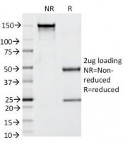 SDS-PAGE Analysis of Purified, BSA-Free Prostate Specific Antibody (KLK3/1248). Confirmation of Integrity and Purity of the Antibody.