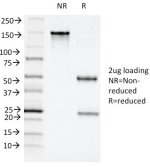 SDS-PAGE Analysis of Purified, BSA-Free CD11c Antibody (clone ITGAX/1243). Confirmation of Integrity and Purity of the Antibody.