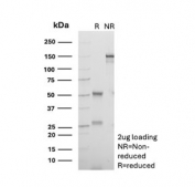 SDS-PAGE Analysis of Purified, BSA-Free CD18 Antibody (clone 68-5A5). Confirmation of Integrity and Purity of the Antibody.