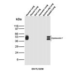 Cytokeratin 7 Antibody OV-TL12/30 by WB in Lung Tissue Lysates from Multiple Species. Western blot analysis of human, mouse, rat, hamster, guinea pig, and rabbit lung tissue lysates using mouse monoclonal Cytokeratin 7 antibody OV-TL12/30. Lanes 1-6 correspond to human, mouse, rat, hamster, guinea pig, and rabbit lung, respectively. Strong immunoreactive bands are detected at approximately 46-53 kDa in human and rabbit lung lysates, consistent with the expected molecular weight range of Keratin 7. No detectable bands are observed in mouse, rat, hamster, or guinea pig lung lysates under the tested conditions. The rabbit sample exhibits multiple closely migrating bands, while the human sample shows a broader principal band.