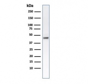 Western blot testing of human HCT-116 cell lysate with Cytokeratin 8 antibody (clone B22.1).