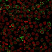 Immunofluorescence analysis of CD10/CALLA antibody in human Ramos cells. CD10/CALLA antibody (clone CB-CALLA) shows membranous staining (green) consistent with cell surface expression of CD10, while nuclei are counterstained with Reddot (red). The staining pattern highlights circumferential membrane localization surrounding individual lymphoma cells, in agreement with known CD10 expression in germinal center-derived B-cell lines.