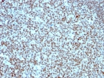 NCL Antibody immunohistochemistry analysis of human tonsil. Formalin-fixed paraffin-embedded human tonsil stained with NCL Antibody (clone 364-5). HRP-DAB brown chromogenic staining highlights nuclei of lymphoid cells within tonsillar tissue, consistent with the nuclear and nucleolar localization of Nucleolin / NCL. Staining of formalin-fixed tissues is enhanced by boiling tissue sections in 10mM citrate buffer, pH 6.0, for 10-20 minutes followed by cooling at RT for 20 minutes.