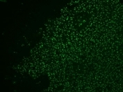 IHC: Formalin-fixed, paraffin-embedded human colon carcinoma stained with AF488 Conjugate of Nucleolin antibody.