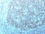 Nucleolin Antibody immunohistochemistry analysis of human tonsil. Formalin-fixed, paraffin-embedded human tonsil stained with Nucleolin Antibody. HRP-DAB brown chromogenic staining highlights nuclei of lymphoid cells within tonsillar tissue, consistent with the expected nuclear and nucleolar localization of Nucleolin / NCL in proliferating immune cell populations.