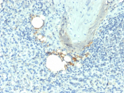 TRAcP Antibody Spleen IHC Macrophage Staining. Immunohistochemistry analysis of Tartrate-resistant acid phosphatase / ACP5 in FFPE human spleen tissue using TRAcP Antibody for IHC. HRP-DAB brown chromogenic staining highlights scattered macrophage-lineage cells within splenic tissue, with cytoplasmic localization consistent with lysosomal enzyme expression, while surrounding lymphoid cells remain largely negative. The staining pattern supports detection of ACP5-positive histiocytic populations within spleen architecture.