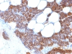 Parathyroid Hormone Antibody N Terminus immunohistochemistry of human parathyroid gland. FFPE human parathyroid tissue stained with Parathyroid Hormone Antibody N Terminus clone SPM604, a mouse monoclonal antibody recognizing the N-terminal region of Parathyroid hormone (PTH). Strong cytoplasmic brown chromogenic staining is observed in parathyroid endocrine chief cells, consistent with the known intracellular localization of Parathyroid hormone in hormone-producing cells of the parathyroid gland.