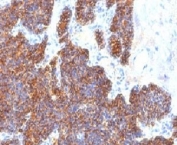 PTH Antibody C Terminus immunohistochemistry of human parathyroid gland. FFPE human parathyroid tissue stained with PTH Antibody C Terminus clone PTH/1173, a mouse monoclonal antibody recognizing the C-terminal region of Parathyroid hormone (PTH). Strong cytoplasmic brown chromogenic staining is observed in parathyroid endocrine chief cells, consistent with the expected intracellular localization of Parathyroid hormone in hormone-producing cells of the parathyroid gland.