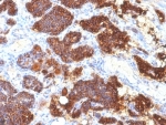 PTH Antibody for IHC immunohistochemistry analysis of Parathyroid hormone in human parathyroid tissue. FFPE human parathyroid tissue was stained using PTH antibody clone PTH/1175 following heat induced epitope retrieval prior to staining. HRP-DAB brown chromogenic signal highlights strong cytoplasmic staining in parathyroid endocrine cells, consistent with the known expression of Parathyroid hormone (PTH) in hormone-producing chief cells that regulate systemic calcium homeostasis. The staining pattern demonstrates robust detection of parathyroid endocrine tissue and supports the use of PTH Antibody for IHC / Parathyroid Hormone Antibody (clone PTH/1175) for immunohistochemistry analysis of PTH expression in human tissue sections.