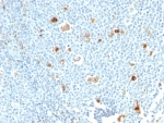 IHC staining of formalin-fixed, paraffin-embedded human tonsil tissue with Calprotectin antibody (CPT/1028). Staining of formalin-fixed tissues requires boiling tissue sections in 10mM Citrate buffer, pH 6.0, for 10-20 min followed by cooling at RT for 20 min.