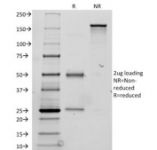 SDS-PAGE Analysis of Purified, BSA-Free Thyroglobulin Antibody / TG Thyroid Hormone Precursor Protein Antibody (clone TGB24). Confirmation of Integrity and Purity of the Antibody.