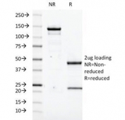 SDS-PAGE Analysis of Purified, BSA-Free Transglutaminase 2 Antibody (clone TGM2/419). Confirmation of Integrity and Purity of the Antibody.