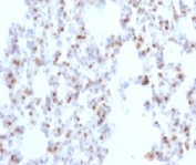 Immunohistochemistry of TTF-1 Antibody / Thyroid Tumor Marker Antibody in rat lung tissue. Formalin-fixed, paraffin-embedded rat lung stained using TTF-1 Antibody / Thyroid Tumor Marker Antibody. The mouse monoclonal clone NX2.1/690 antibody shows nuclear staining in pulmonary epithelial cells consistent with the nuclear localization of Thyroid transcription factor 1 (NKX2-1), a transcription factor expressed in respiratory epithelium and thyroid follicular cells. In lung tissue, NKX2-1 expression highlights pulmonary epithelial lineage, particularly alveolar epithelial cells, reflecting the role of TTF-1 as a key regulator of lung epithelial differentiation and respiratory epithelial identity.