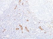 VEGF Antibody Human Tonsil IHC. Immunohistochemical staining of FFPE human tonsil tissue using VEGF Antibody (clone VEGF/1063). An HRP-conjugated secondary antibody with DAB substrate was used for detection. VEGF Antibody / VEGFA demonstrates VEGF expression in vascular structures and stromal-associated cells, consistent with the role of VEGFA in endothelial cell signaling, angiogenesis regulation, vascular remodeling, and tissue homeostasis.