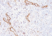 VEGF Antibody Human Tonsil Vasculature IHC. Immunohistochemical staining of FFPE human tonsil tissue using VEGF Antibody (clone VEGF/1063). An HRP-conjugated secondary antibody with DAB substrate was used for detection. VEGF Antibody / VEGFA demonstrates prominent staining of vascular and stromal-associated structures, consistent with VEGFA expression in endothelial signaling, angiogenesis regulation, vascular remodeling, and maintenance of tissue microenvironments.