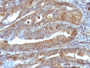 Vimentin Antibody Uterus IHC.  Immunohistochemistry analysis of formalin-fixed, paraffin-embedded human uterus stained with anti-Vimentin antibody (clone VM1170).