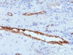vWF Antibody Clone IIIE2.34 immunohistochemistry analysis. IHC staining of FFPE human tonsil using vWF Antibody Clone IIIE2.34 demonstrates HRP-DAB brown staining localized to vascular endothelial cells, highlighting elongated vessel structures within lymphoid tissue. The signal is confined to vessel linings with minimal background in surrounding lymphocytes, consistent with the known endothelial distribution of von Willebrand factor (VWF).