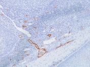 vWF Antibody Clone IIIE2.34 immunohistochemistry analysis. IHC staining of FFPE human tonsil using vWF Antibody Clone IIIE2.34 demonstrates HRP-DAB brown staining in vascular endothelial cells, highlighting vessel structures within lymphoid tissue. The staining is localized to vessel linings with minimal background in surrounding lymphocytes, consistent with the known endothelial expression of von Willebrand factor (VWF). Heat-induced epitope retrieval was performed using pH 9 Tris-EDTA buffer, supporting clear visualization of vascular endothelium.